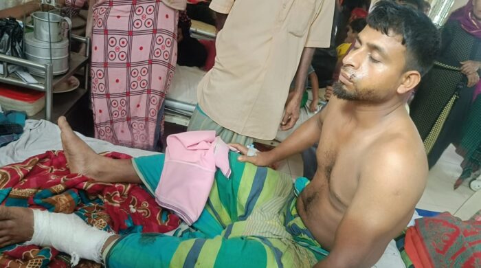 নাসিরনগরে পারিবারিক বিরোধে তরুণের পায়ের রগ কেটে দেওয়ার অভিযোগ